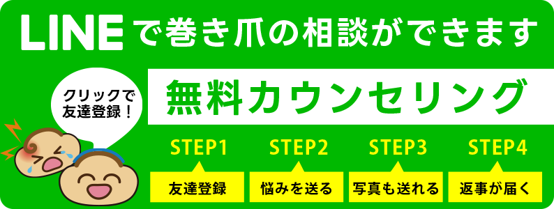 神戸三宮巻き爪センターへLINEで無料相談