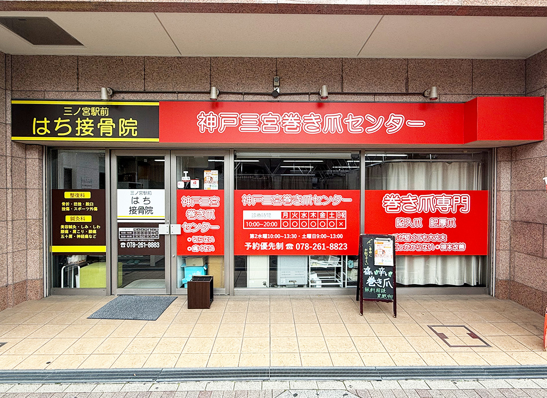 しっかり矯正で改善